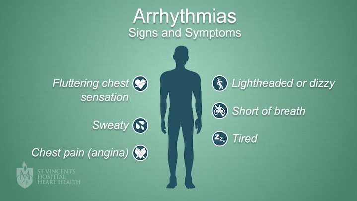 Arrhythmias St Vincent s Heart Health