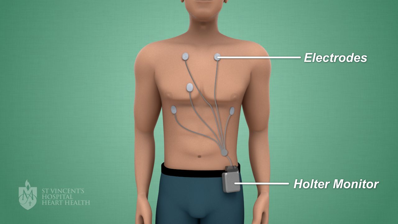heart monitor holter